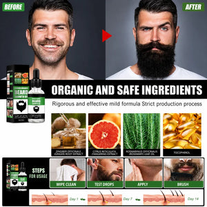 Natural Ginger Beard Growth Oil for Men Organic Facial Hair Growth Serum 30ml