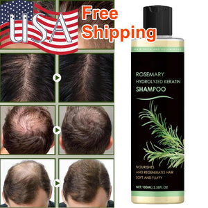 Organic Rosemary Hair Growth Shampoo for Women and Men Thinning Thickening Hair